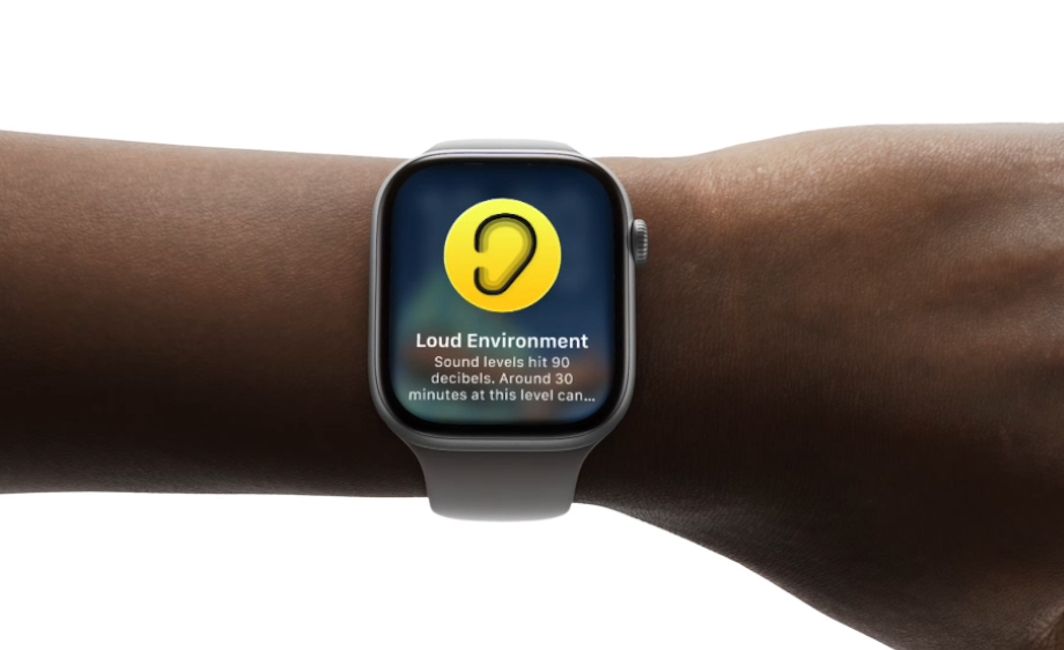 Apple Watch Series 11 in hand design showcased Apple Watch Series 11 in hand design showcased