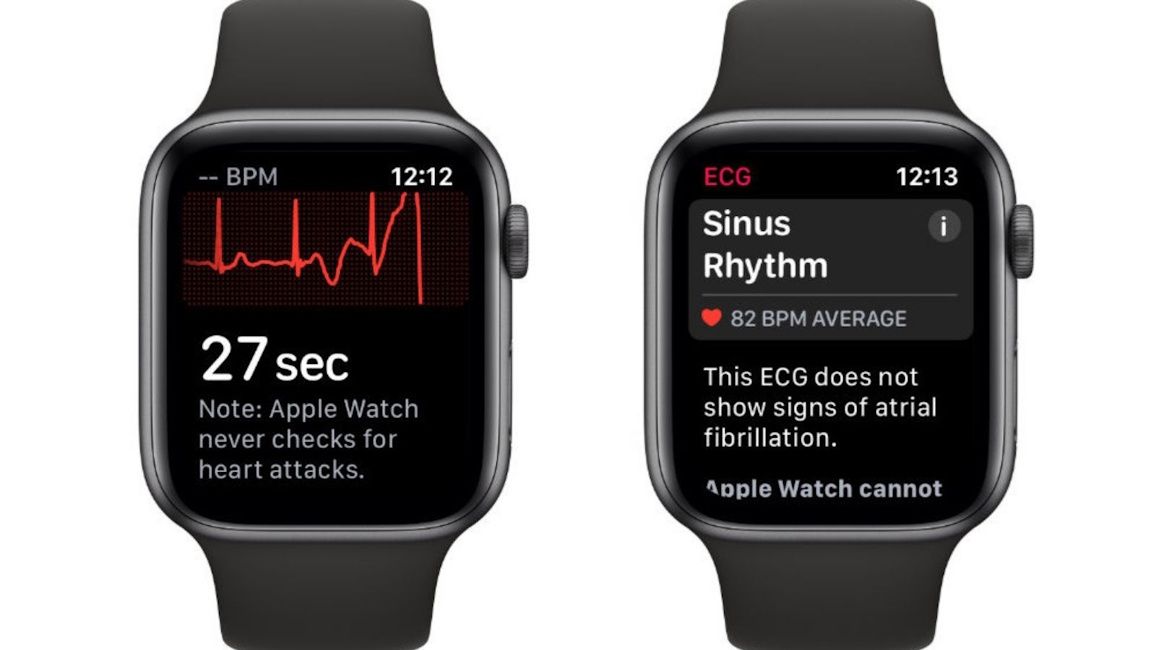 Heart rate monitoring in Apple Watch Heart rate monitoring in Apple Watch